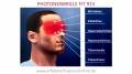 Bild 4 von Fotobiologische Intensiv Therapie, Photonenbrille EYES FIT 915, Jossner, Medical Electronics